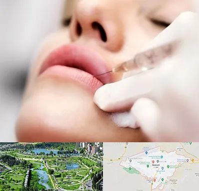 کلینیک تزریق ژل لب در بجنورد