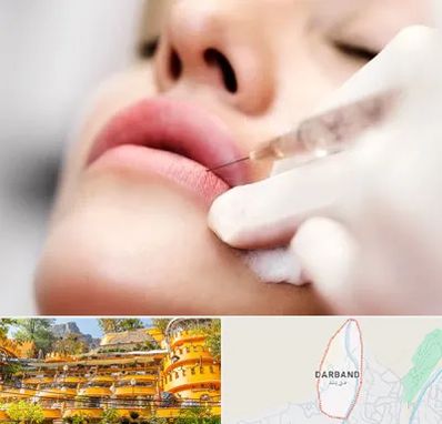 کلینیک تزریق ژل لب در دربند