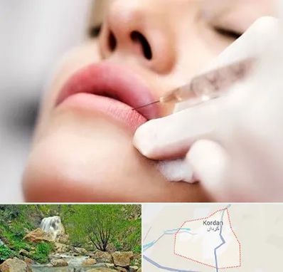 کلینیک تزریق ژل لب در کردان