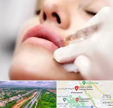 کلینیک تزریق ژل لب در قصرالدشت شیراز