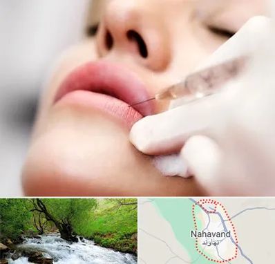 کلینیک تزریق ژل لب در نهاوند