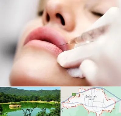 کلینیک تزریق ژل لب در بهشهر