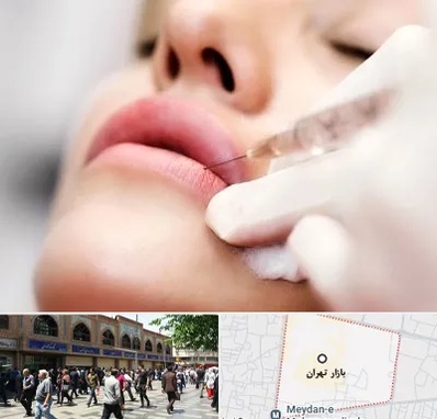 کلینیک تزریق ژل لب در بازار تهران