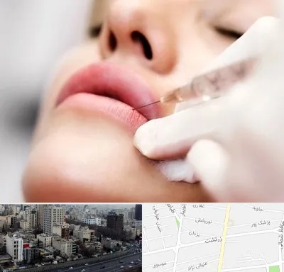 کلینیک تزریق ژل لب در زرتشت