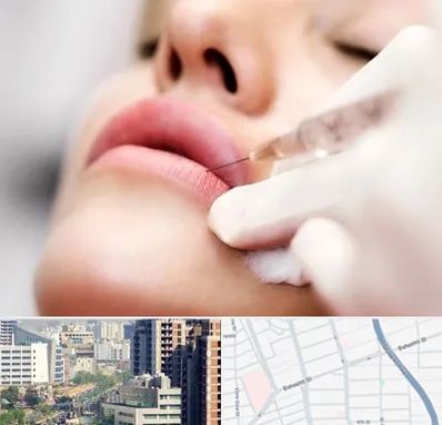کلینیک تزریق ژل لب در خیابان بهشتی
