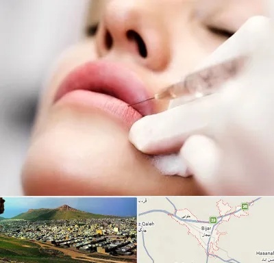 کلینیک تزریق ژل لب در بیجار