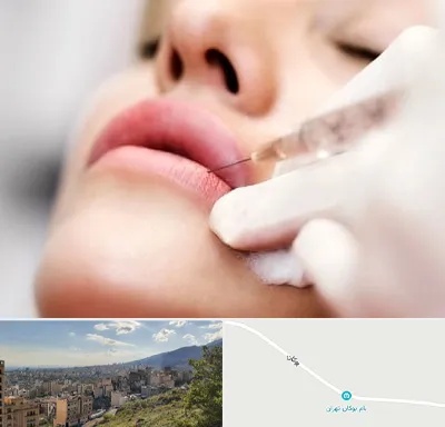 کلینیک تزریق ژل لب در بوکان تهران