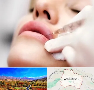 کلینیک تزریق ژل لب در خراسان شمالی