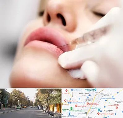 کلینیک تزریق ژل لب در شریعتی