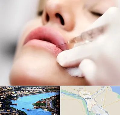کلینیک تزریق ژل لب در خرمشهر