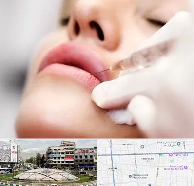 کلینیک تزریق ژل لب در مرکز تهران