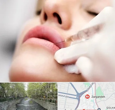 کلینیک تزریق ژل لب در زرگنده