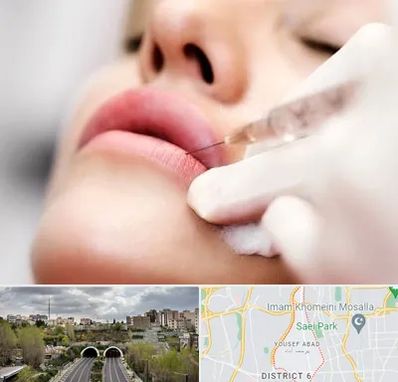 کلینیک تزریق ژل لب در یوسف آباد