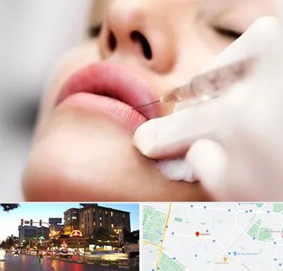 کلینیک تزریق ژل لب در بلوار سجاد مشهد