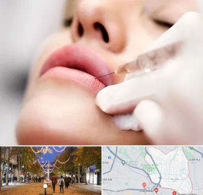 کلینیک تزریق ژل لب در ولیعصر ارومیه