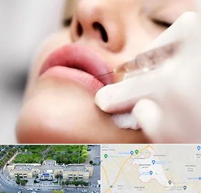 کلینیک تزریق ژل لب در نسیم شهر