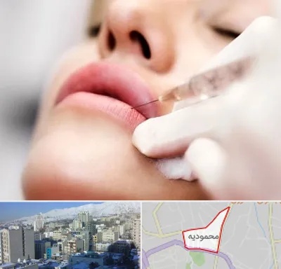 کلینیک تزریق ژل لب در محمودیه