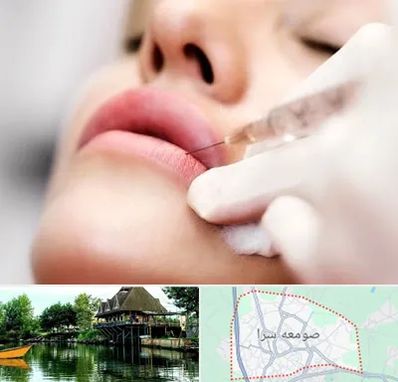 کلینیک تزریق ژل لب در صومعه سرا