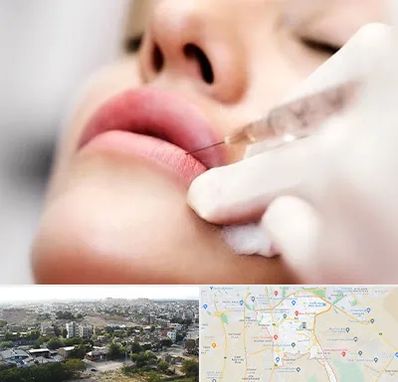 کلینیک تزریق ژل لب در منطقه 20 تهران