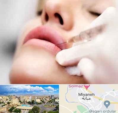 کلینیک تزریق ژل لب در میانه
