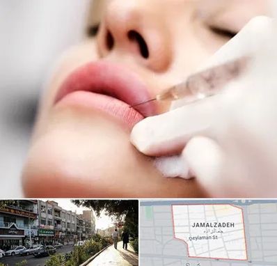 کلینیک تزریق ژل لب در خیابان جمالزاده