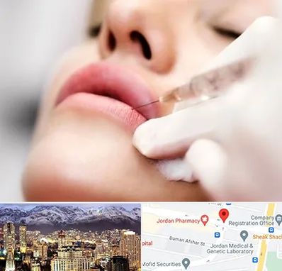 کلینیک تزریق ژل لب در جردن