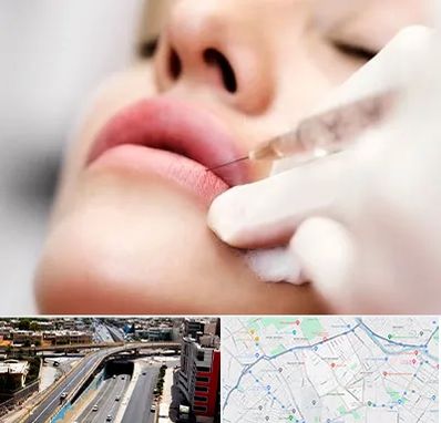 کلینیک تزریق ژل لب در ستارخان شیراز