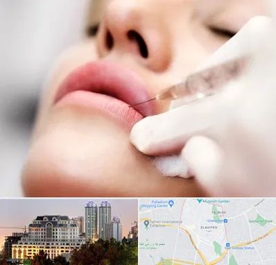 کلینیک تزریق ژل لب در فرشته