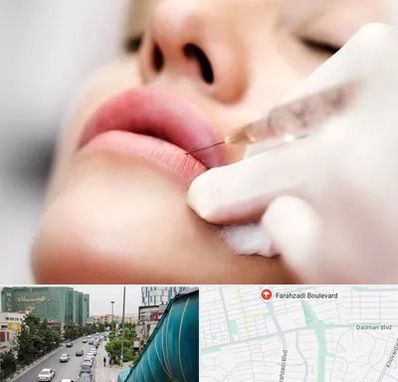کلینیک تزریق ژل لب در بلوار فرحزادی