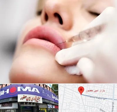 کلینیک تزریق ژل لب در امین حضور