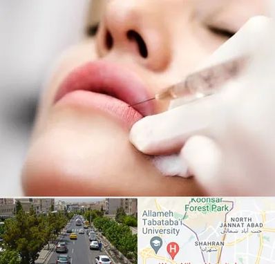 کلینیک تزریق ژل لب در شهران