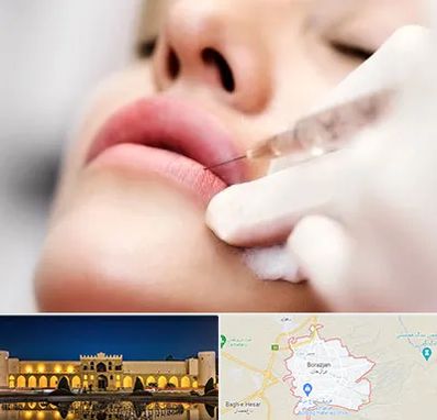 کلینیک تزریق ژل لب در برازجان