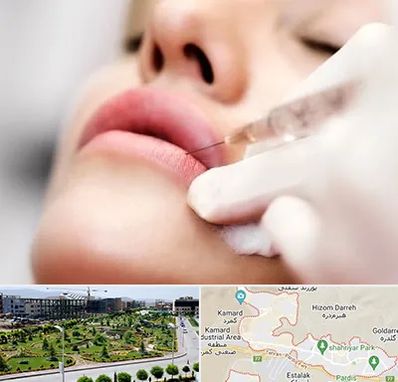 کلینیک تزریق ژل لب در پردیس