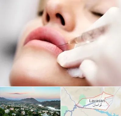 کلینیک تزریق ژل لب در لواسان