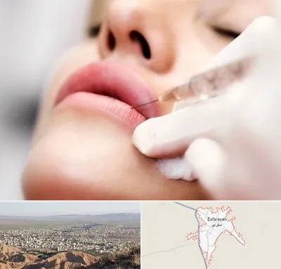 کلینیک تزریق ژل لب در اسفراین