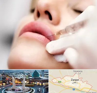 کلینیک تزریق ژل لب در زنجان