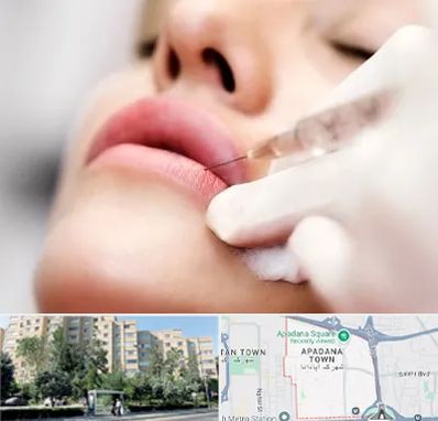 کلینیک تزریق ژل لب در آپادانا