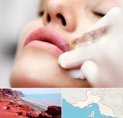 کلینیک تزریق ژل لب در هرمزگان