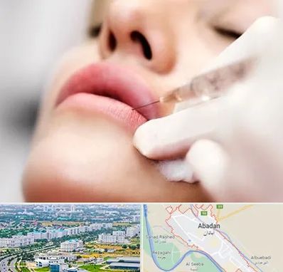 کلینیک تزریق ژل لب در آبادان