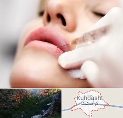 کلینیک تزریق ژل لب در کوهدشت