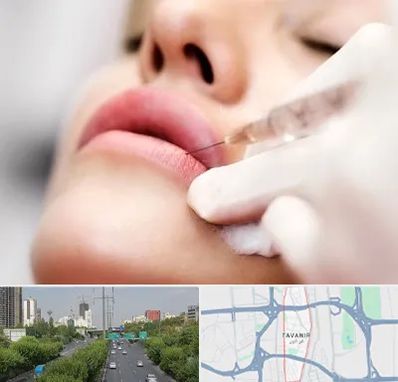کلینیک تزریق ژل لب در توانیر