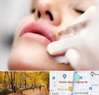 کلینیک تزریق ژل لب در چهارباغ اصفهان