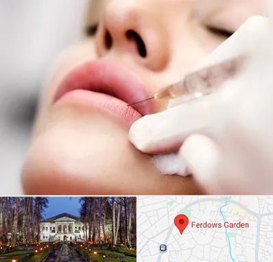 کلینیک تزریق ژل لب در باغ فردوس
