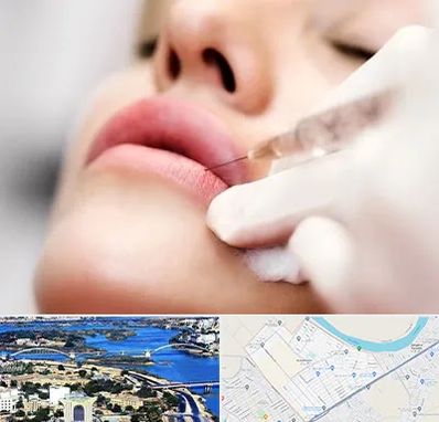 کلینیک تزریق ژل لب در کوروش اهواز