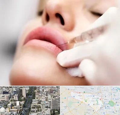 کلینیک تزریق ژل لب در منطقه 18 تهران