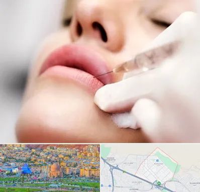 کلینیک تزریق ژل لب در رشدیه تبریز