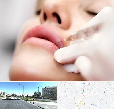 کلینیک تزریق ژل لب در بلوار کلاهدوز مشهد