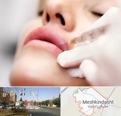 کلینیک تزریق ژل لب در مشکین دشت