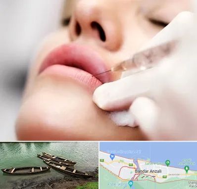 کلینیک تزریق ژل لب در بندر انزلی