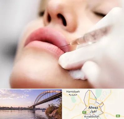 کلینیک تزریق ژل لب در اهواز
